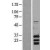 Western Blot: PUMA Lysate [NBL1-07925] - Western Blot experiments. 
Left-Control; Right -Over-expression Lysate for BBC3